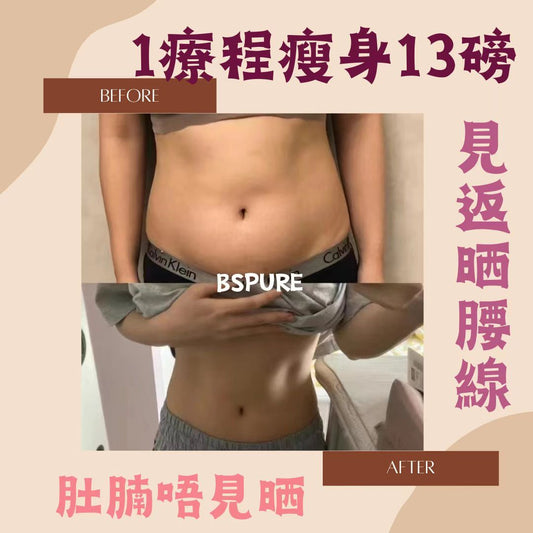 客人案例：1療程瘦13磅！出返腰線，肚腩冇晒