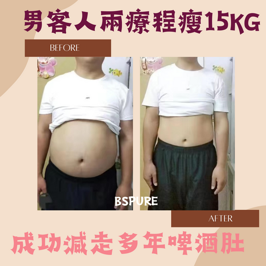 客人案例：男客人兩療程減15KG！